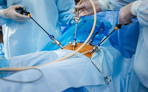 Hernia Repair